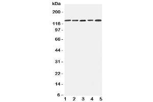Western blot testing of Integrin alpha 7 antibody and Lane 1:  293T (ITGA7 antibody  (C-Term))
