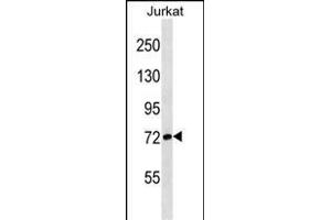 G7L Antibody (E37) 1813a western blot analysis in Jurkat cell line lysates (35 μg/lane). (ATG7 antibody  (N-Term))