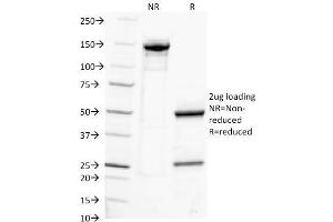 SDS-PAGE Analysis Purified IgG Monoclonal Antibody (IG217). (IGHG antibody)
