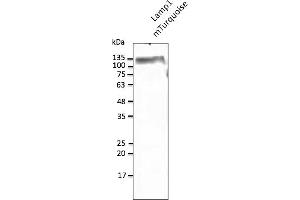 Western Blotting (WB) image for anti-mTurquoise Fluorescent Protein antibody (ABIN7273076) (mTurquoise Fluorescent Protein antibody)