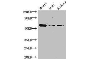 Western Blot Positive WB detected in: Mouse heart tissue, Mouse lung tissue, Mouse kidney tissue All lanes: Gcgr antibody at 3 μg/mL Secondary Goat polyclonal to rabbit IgG at 1/50000 dilution Predicted band size: 55 kDa Observed band size: 55 kDa (Glucagon Receptor antibody  (AA 26-136))