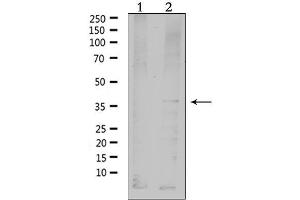 Western blot analysis of extracts from HepG2, using MC4R Antibody. (MC4R antibody  (C-Term))
