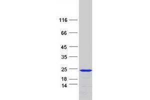 Validation with Western Blot (SNX12 Protein (Myc-DYKDDDDK Tag))