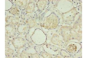 Immunohistochemistry of paraffin-embedded human kidney tissue using ABIN7142054 at dilution of 1:100 (PLCD4 antibody  (AA 1-762))
