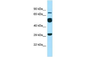 Western Blotting (WB) image for anti-Rab11 Family-Interacting Protein 1 (RAB11FIP1) (N-Term) antibody (ABIN2499665) (RAB11FIP1 antibody  (N-Term))