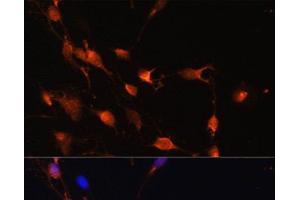 Immunofluorescence analysis of C6 cells using RAB11A Polyclonal Antibody at dilution of 1:100. (RAB11A antibody)