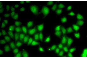 Immunofluorescence analysis of A-549 cells using WNT7A Polyclonal Antibody (WNT7A antibody)