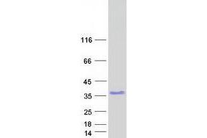 Validation with Western Blot (ZNF146 Protein (Transcript Variant 1) (Myc-DYKDDDDK Tag))