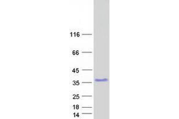 ZNF146 Protein (Transcript Variant 1) (Myc-DYKDDDDK Tag)