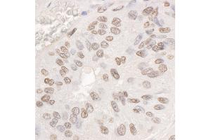 Immunohistochemistry (IHC) image for anti-DEAD (Asp-Glu-Ala-Asp) Box Polypeptide 17 (DDX17) (C-Term) antibody (ABIN7449385) (DDX17 antibody  (C-Term))