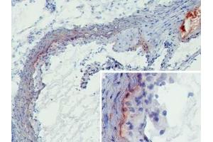 Mbl1 antibody