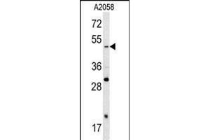 SOX4 Antikörper  (N-Term)