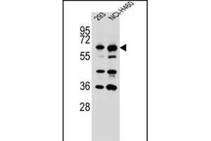 CK Antibody (C-term) (ABIN656313 and ABIN2845615) western blot analysis in 293,NCI- cell line lysates (35 μg/lane).