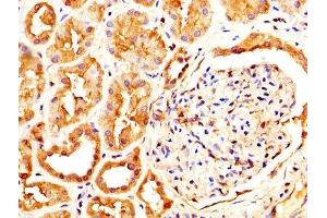IHC image of ABIN7146077 diluted at 1:600 and staining in paraffin-embedded human kidney tissue performed on a Leica BondTM system. (CLEC4E antibody  (AA 41-219))
