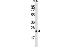Western Blotting (WB) image for anti-Fibroblast Growth Factor 4 (FGF4) antibody (ABIN3003719)