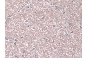 Immunohistochemistry (IHC) image for anti-Phospholipase D (PLD) (AA 725-1074) antibody (ABIN7434611)