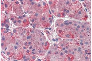 Human, Stomach: Formalin-Fixed Paraffin-Embedded (FFPE) (ERP44 antibody  (C-Term))