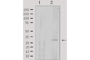 Western Blotting (WB) image for anti-Activating Transcription Factor 1 (AFT1) (Internal Region) antibody (ABIN6256913)