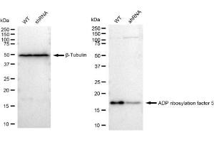 Western blotting analysis using ADP ribosylation factor 5 antibody (ABIN7797531). (Recombinant ARF5 antibody)