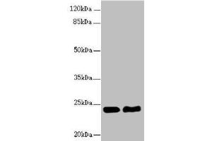 Western blot All lanes: RAB5B antibody at 5. (RAB5B antibody  (AA 1-215))
