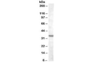 Western blot testing of K562 lysate with BDKRB1 antibody at 2ug/ml. (BDKRB1 antibody)