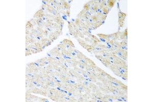 Immunohistochemistry of paraffin-embedded mouse heart using GABARAPL2 antibody at dilution of 1:200 (40x lens).