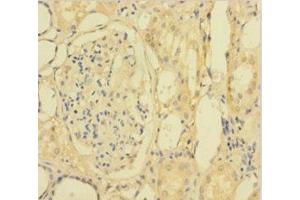 Immunohistochemistry of paraffin-embedded human kidney tissue using ABIN7154460 at dilution of 1:100 (PLA2G2D antibody  (AA 22-145))