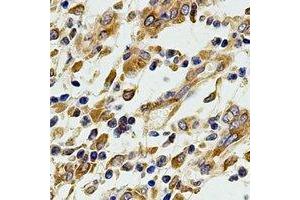Immunohistochemical analysis of EIF3A staining in human stomach formalin fixed paraffin embedded tissue section.