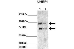Western Blotting (WB) image for anti-Ubiquitin-Like, Containing PHD and RING Finger Domains, 1 (UHRF1) (N-Term) antibody (ABIN2780898)