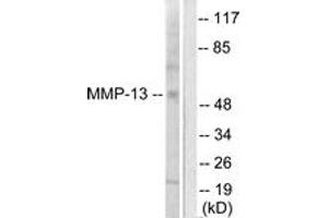 Western blot analysis of extracts from LOVO cells, using MMP-13 Antibody. (MMP13 antibody  (AA 10-59))