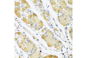 Immunohistochemistry of paraffin-embedded human stomach using C4BPB antibody (ABIN5973770) at dilution of 1/100 (40x lens).