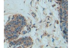 DAB staining on IHC-P; Samples: Human Mammary gland Tissue (PDGF-BB Homodimer (AA 82-190) antibody)