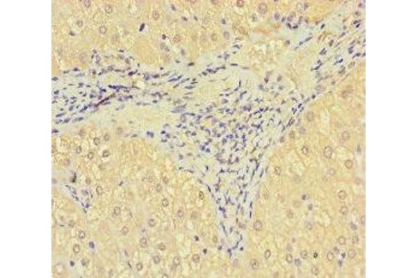 SRPK3 antibody  (AA 1-300)