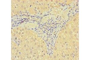 Immunohistochemistry of paraffin-embedded human liver tissue using ABIN7170681 at dilution of 1:100 (SRPK3 antibody  (AA 1-300))