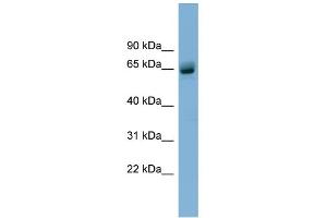 WB Suggested Anti-SLFN12 Antibody Titration: 0. (SLFN12 antibody  (N-Term))
