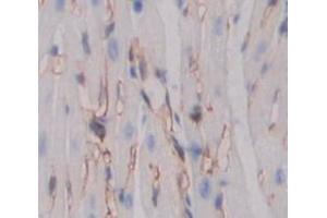 Figure. (PIKFYVE antibody  (AA 1680-1931))