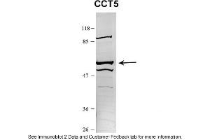 Sample Type: HEK 293 (10ug)Primary Dilution: 1:1000Secondary Antibody: conjugated goat anti-rabbitSecondary Dilution: 1:10,000Image Submitted By: Amy GrayBrigham Young University (CCT5 antibody  (N-Term))