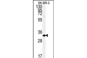 Western blot analysis of FA1 Antibody (Center) (ABIN651364 and ABIN2840202) in SK-BR-3 cell line lysates (35 μg/lane). (FAM92A1 antibody  (AA 113-141))
