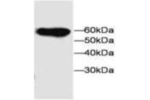Image no. 1 for anti-Microfibrillar-Associated Protein 3-Like (MFAP3L) antibody (ABIN791551) (MFAP3L antibody)