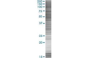 E2F4 transfected lysate. (E2F4 293T Cell Transient Overexpression Lysate(Denatured))