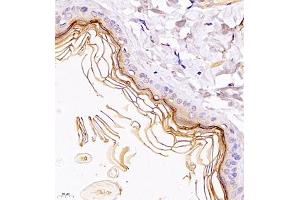 Immunohistochemistry of paraffin embedded rat skin using TR2IT1 (ABIN7075887) at dilution of 1:1500 (400x lens) (TXNRD3NB antibody)