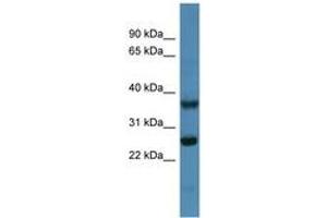 Image no. 1 for anti-ATP Synthase, H+ Transporting, Mitochondrial Fo Complex, Subunit B1 (ATP5F1) (AA 45-94) antibody (ABIN6746288) (ATP5F1 antibody  (AA 45-94))