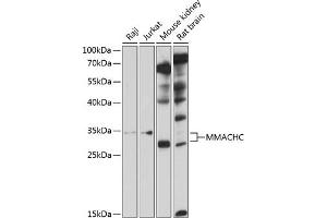 Western blot analysis of extracts of various cell lines, using MMACHC antibody  at 1:1000 dilution. (MMACHC antibody  (AA 63-282))