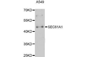 Western blot analysis of extracts of A-549 cells, using SEC61A1 Antibody (ABIN5998768) at 1:3000 dilution. (SEC61A1 antibody)