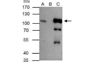 IP Image B-Raf antibody [N2C1], Internal immunoprecipitates B-Raf protein in IP experiments. (SNRPE antibody  (Internal Region))