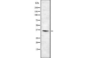 Western blot analysis of TAS2R46 using HUVEC whole cell lysates (TAS2R46 antibody)