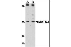 Western blot analysis of MATN3 in 3T3 cell lysate with this product at (A) 1 and (B) 2 μg/ml. (Matrilin 3 antibody  (C-Term))