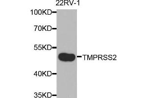 Western blot analysis of extracts of 22Rv1 cells, using TMPRSS2 antibody (ABIN5975349) at 1/2000 dilution. (TMPRSS2 antibody)
