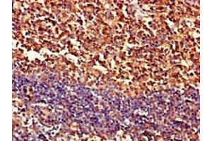 Immunohistochemistry of paraffin-embedded human tonsil tissue using ABIN7162982 at dilution of 1:100 (PIPOX antibody  (AA 259-337))