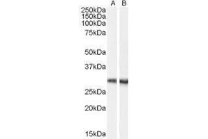 Western Blotting (WB) image for Doublecortin Domain Containing 2 (DCDC2) peptide (ABIN369575)